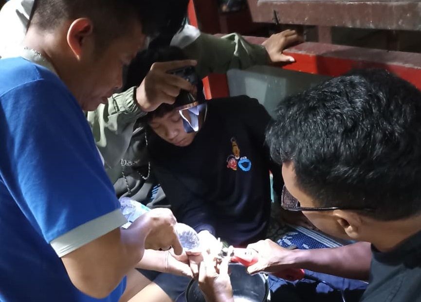 Personel Damkar Wonogiri melepaskan sparepart sepeda motor yang tersangkut di jari remaja asal Kecamatan Sidoharjo, Sabtu (28/6/2025) dini hari.