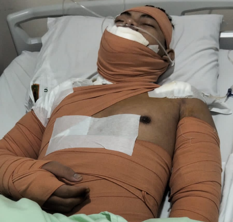 Karyawan SPPG Mojosongo menjalani perawatan usai minyak panas mengenai tubuh dan wajahnya