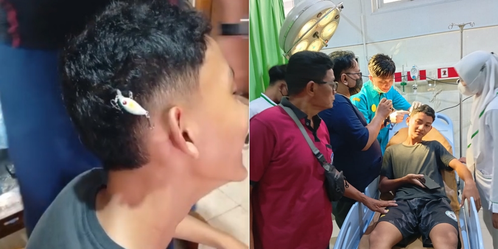 Mata pancing yang tersangkut di kepala Aga, pelajar SMPN 1 Wonogiri. Foto kanan, upaya pertolongan oleh personel Damkar dan tenaga medis RSUUD Wonogiri.
