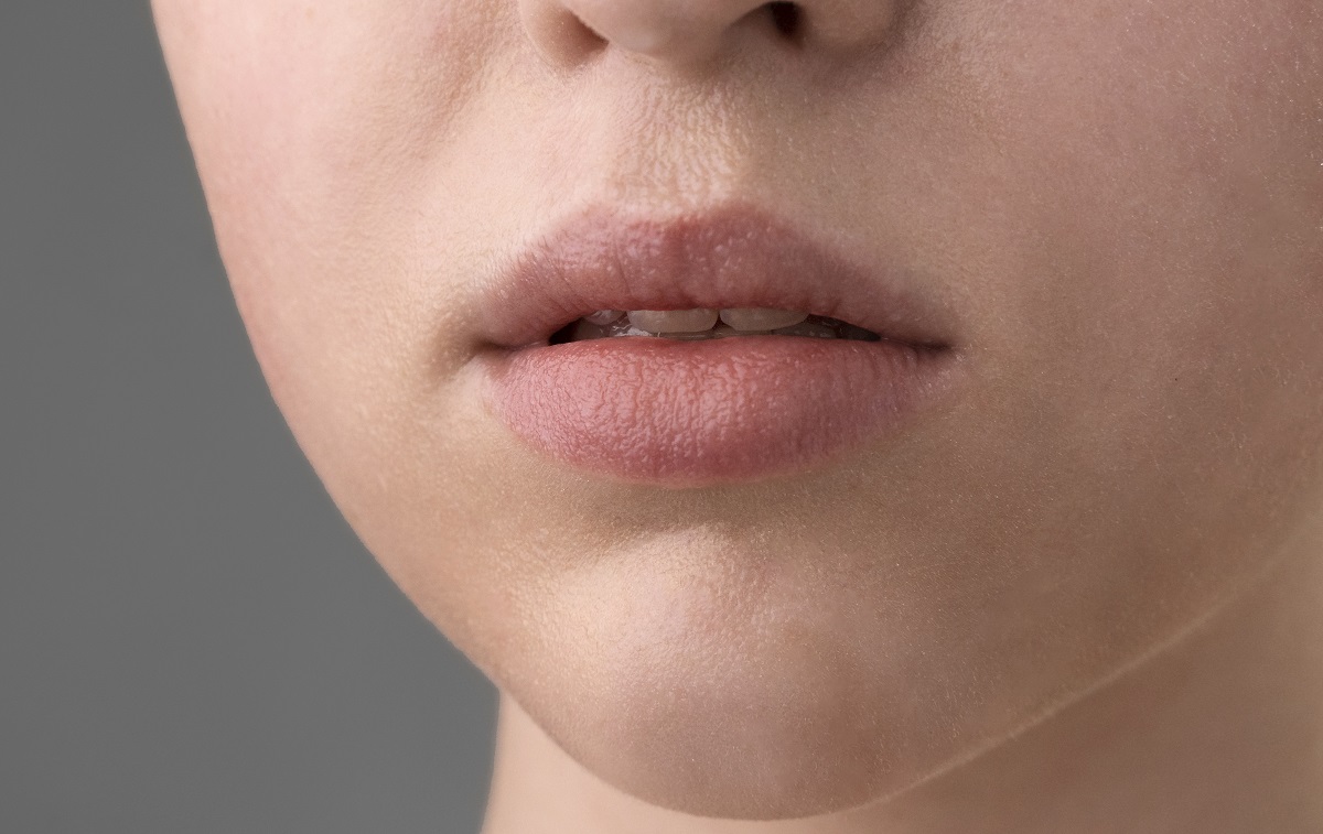 Ilustrasi bibir pecah.