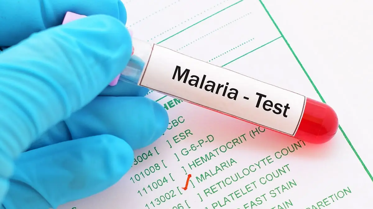 Sejumlah kata modern seperti disaster, malaria, hingga panic menyimpan jejak kepercayaan kuno tentang bintang, mitologi, dan udara buruk.
