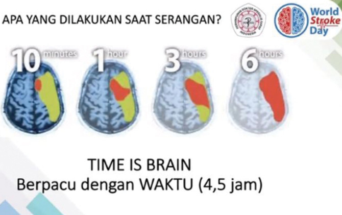 Infografis waktu penanganan stroke. (ANTARA)