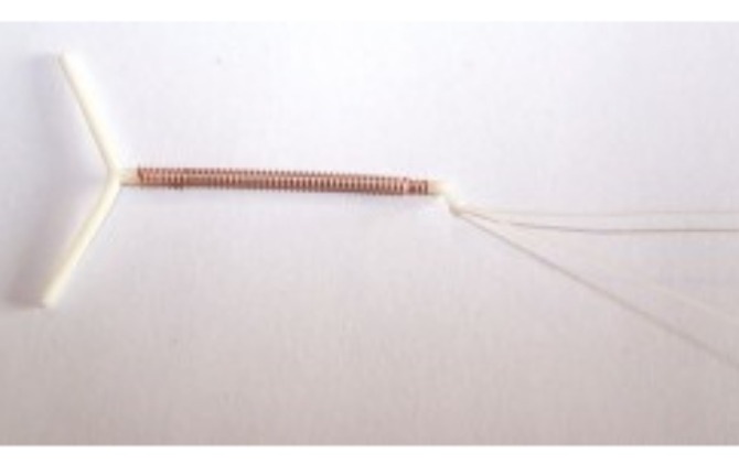 Alat kontrasepsi IUD