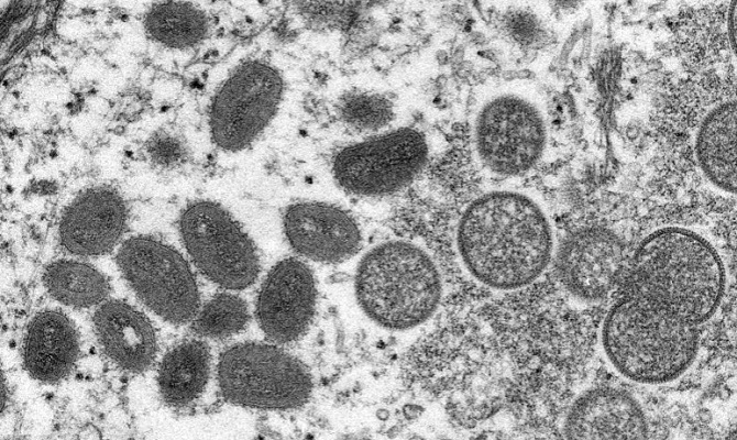 Ilustrasi wujud virus. Virus Hendra kembali muncul pada kuda di Queensland, Australia. (CDC)