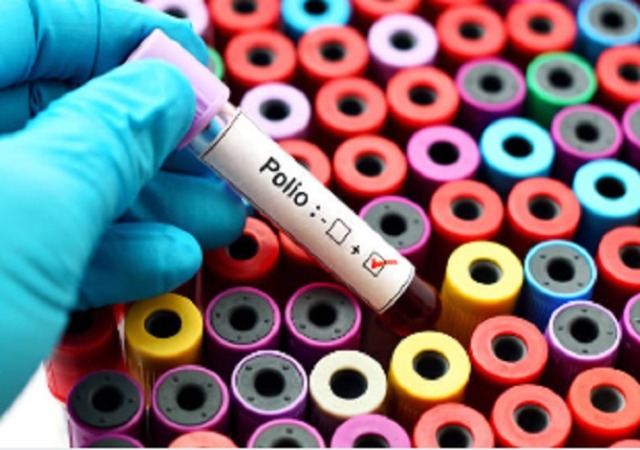 Ilustrasi positif virus polio. Kanada melaporkan kasus pertama virus polio dalam 1 dekade terakhir. (iStock)