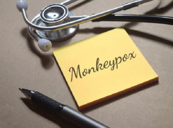 Ilustrasi diagnosis cacar monyet. Sebagian pasien yang dinyatakan positif cacar monyet juga bisa tak merasakan gejala. (Shutterstock)