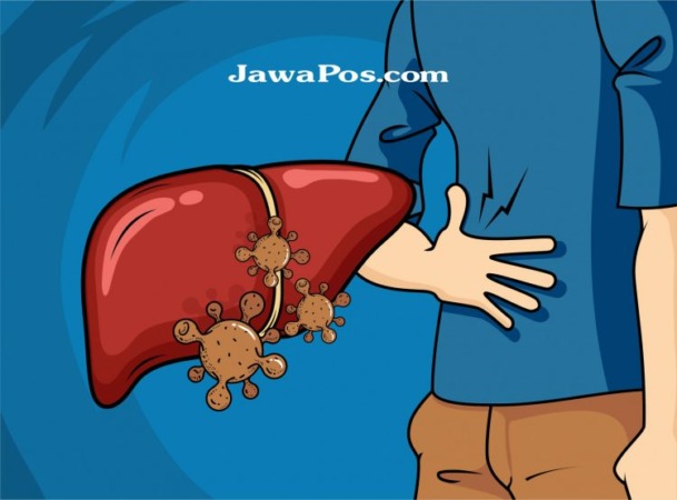Ilustrasi Hepatitis akut misterius. (Dimas Pradipta/JawaPos.com)