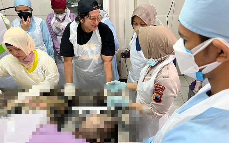 Proses otopsi terhadap potongan tubuh manusia di RSUD Dr Moewardi Solo. (ISTIMEWA)