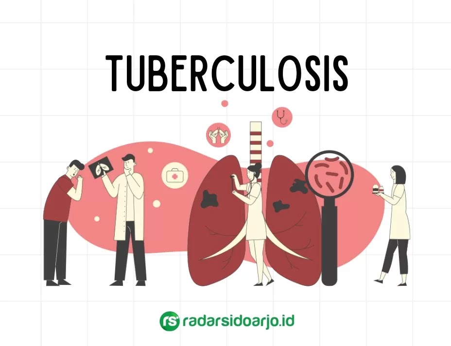 Ilustrasi TBC. (M SAIFUL ROHMAN/RADAR SIDOARJO)