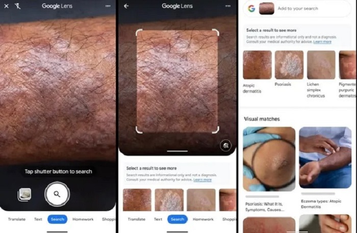 Ilustrasi fitur deteksi kulit google lens