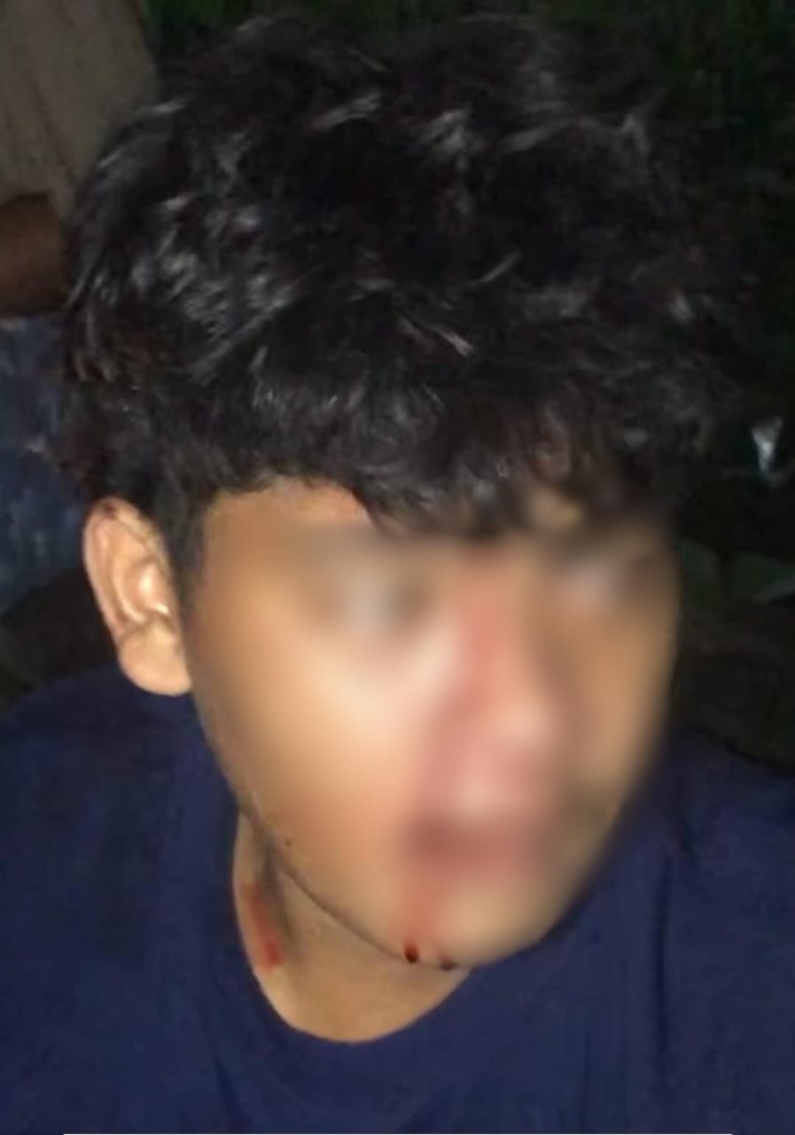Kondisi pria yang diduga maling motor usai dimassa warga hingga kepalanya berdarah.