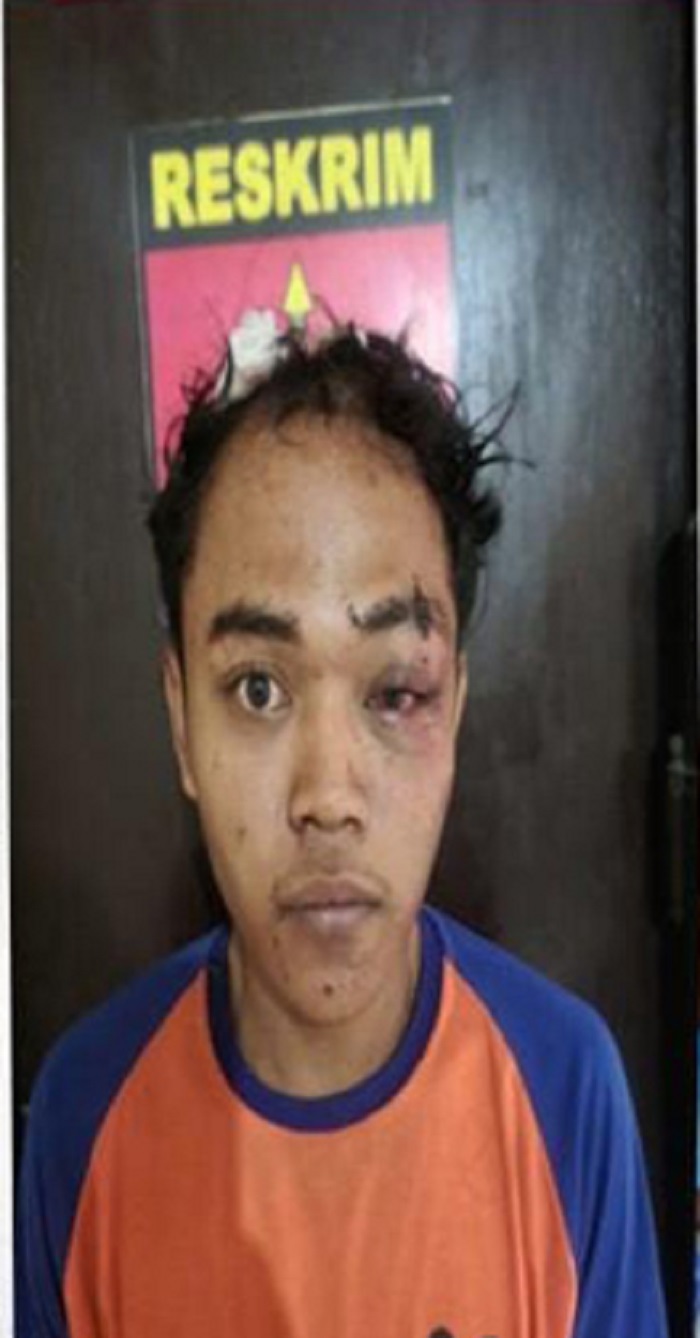 Gangster yang dimassa warga usai keroyok pemuda kini jadi tersangka