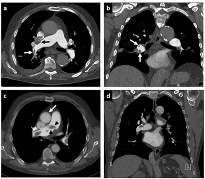 Sumber: (Pannenbecker et al., 2023)