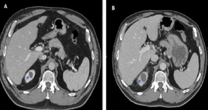(Sumber foto: Mansour et al., 2023)