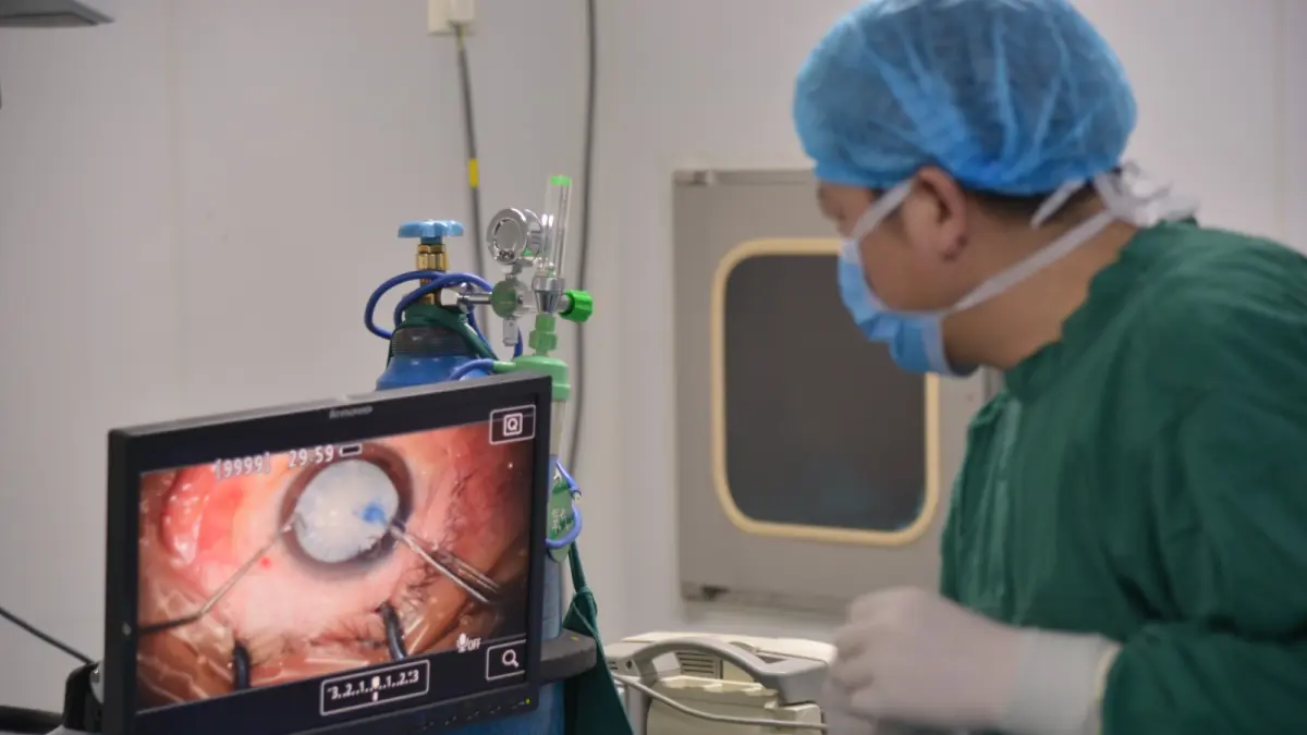 Ilustrasi operasi LASIK (Pixabay.com/ hysw001! )