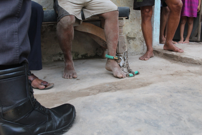 Kaki kiri Mujib, 62, warga Dusun Candi, Desa SIdomulyo, Kecamatan Jombang ini dirantai.