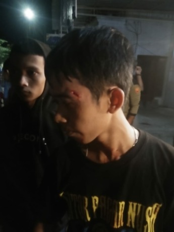 Pemuda yang mengaku warga perak korban pelemparan batu di Jl Kusuma Bangsa. Korban beserta 10 rekannya, sedang ngopi, kemudian diserang gerombolan pemotor dengan lemparan batu.