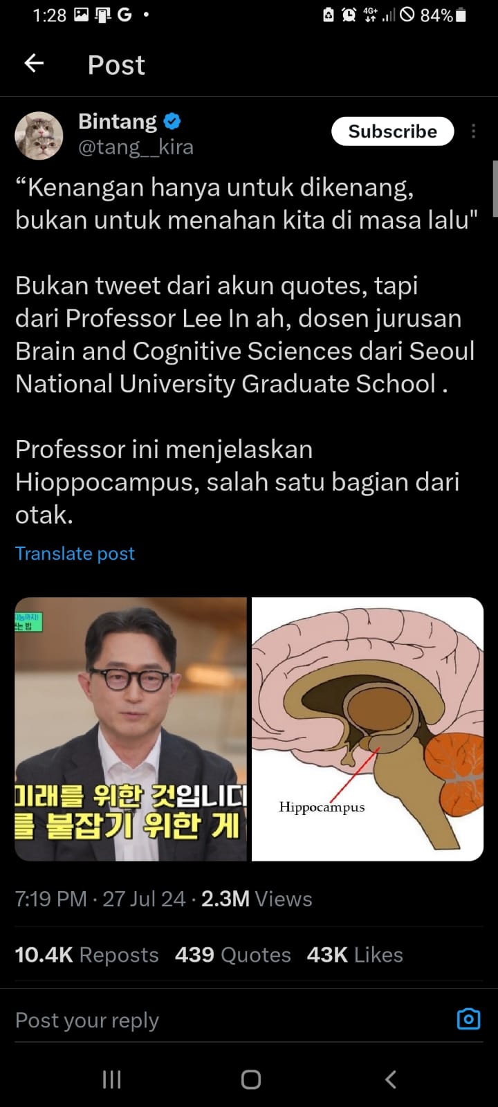 Professor Lee In Ah, salah satu dosen jurusan Brain and Cognitive Sciences dari Seoul National University menjelaskan mengenai salah satu bagian yang ada di otak manusia.