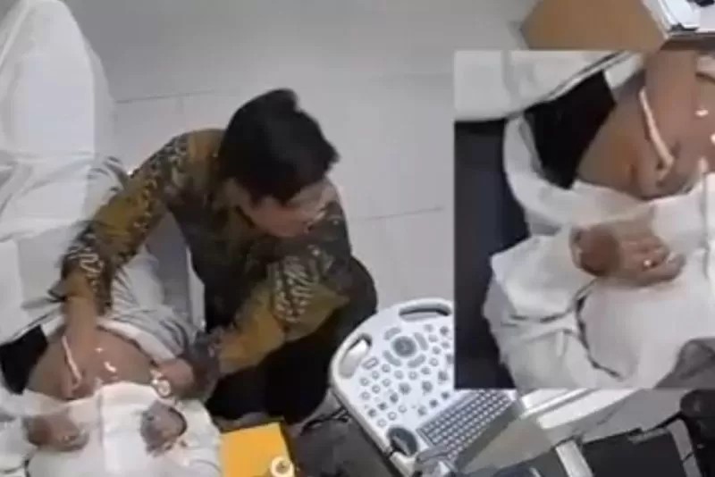 Video dokter kandungan saat melakukan USG sambil meraba payudara pasien viral di media sosial.