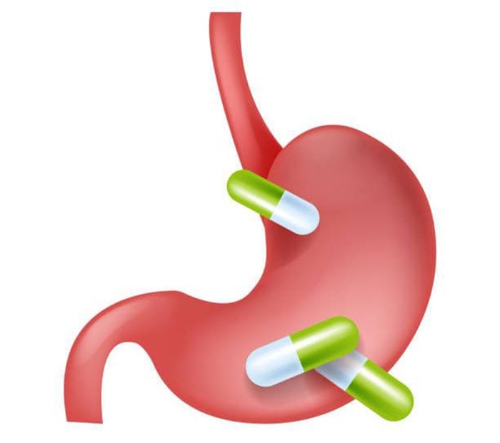 Ilustrasi lambung yang sering konsumsi obat