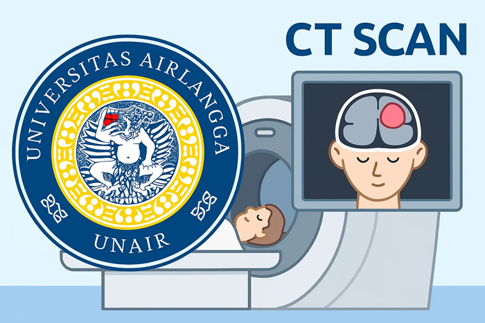 Opini dari civitas akademika Universitas Airlangga tentang Giant Cell Tumour (GCT) bisa muncul di tengkorak dan menyebabkan gangguan neurologis.