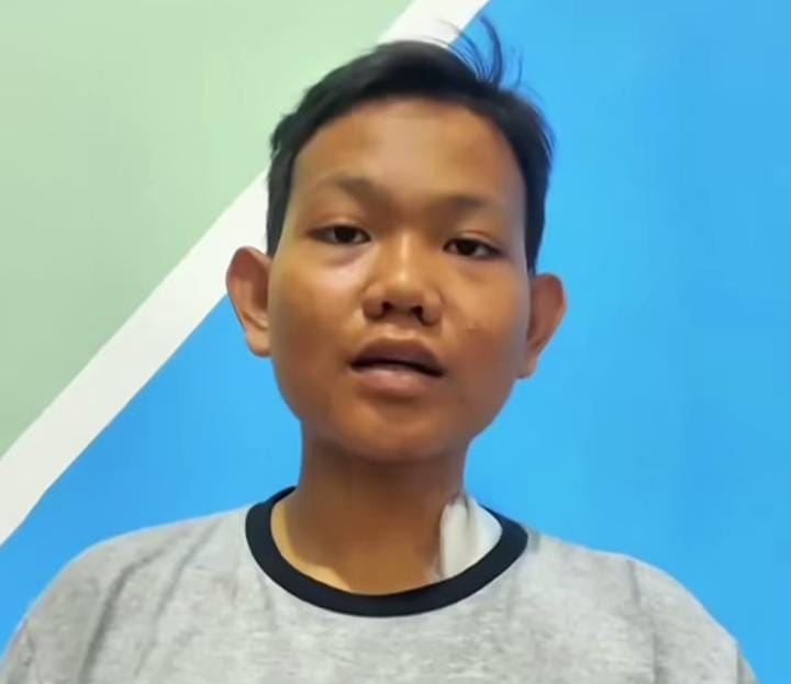 Di usia 15 tahun, remaja ini alami gagal ginjal karena pola hidup tidak sehat