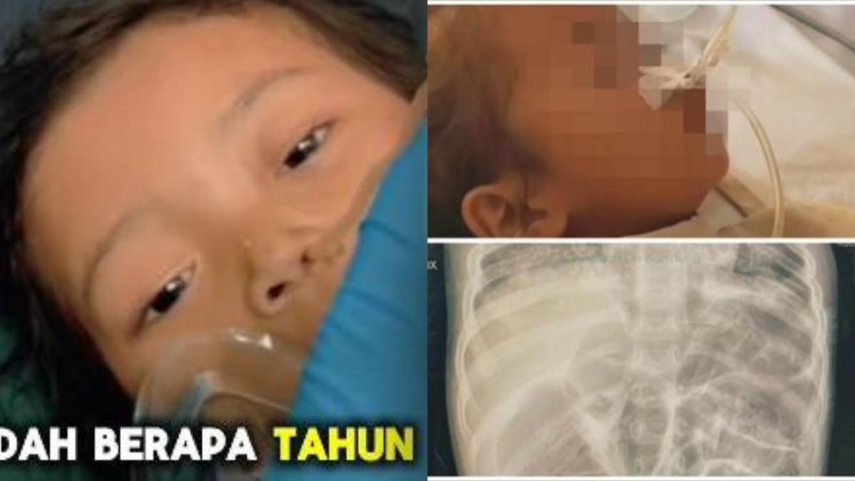Raya, balita asal sukabumi yang meninggal