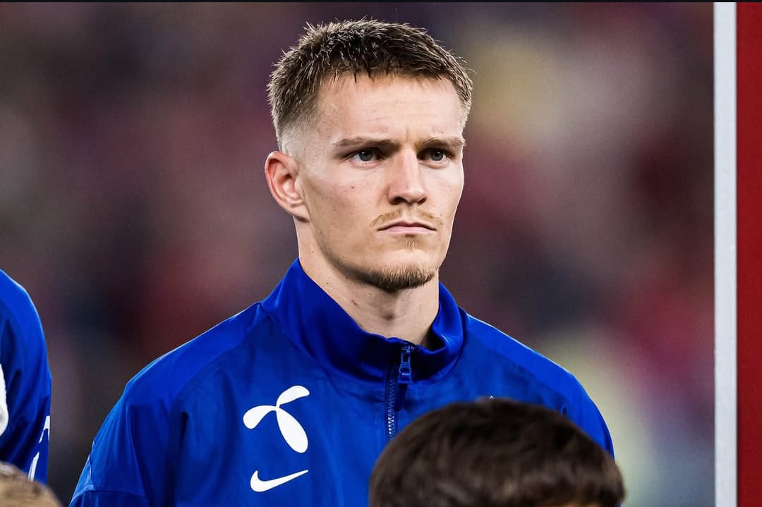 Kaptek Arsenal sekaligus Timnas Norwegia, Martin Odegaard, alami cedera lutut.