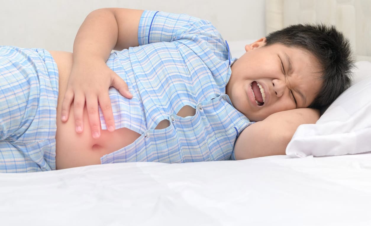 Cacingan pada anak adalah infeksi parasit yang mencuri nutrisi dan menyebabkan sakit perut