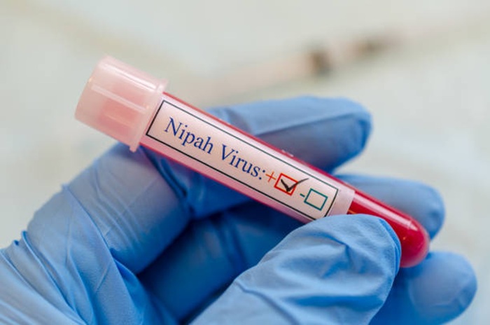 Ilustrasi virus Nipah.