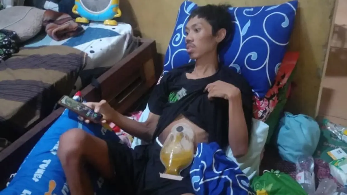 Kondisi Mohammad Nasirudin, pasien kanker usus asal Desa Lajukidul, Kecamatan Singgahan yang hanya bisa terbaring lemas seiring kondisi kesehatan yang kian melemas. Hingga saat ini belum bisa kontrol karena kehabisan biaya. (Radar Tuban)