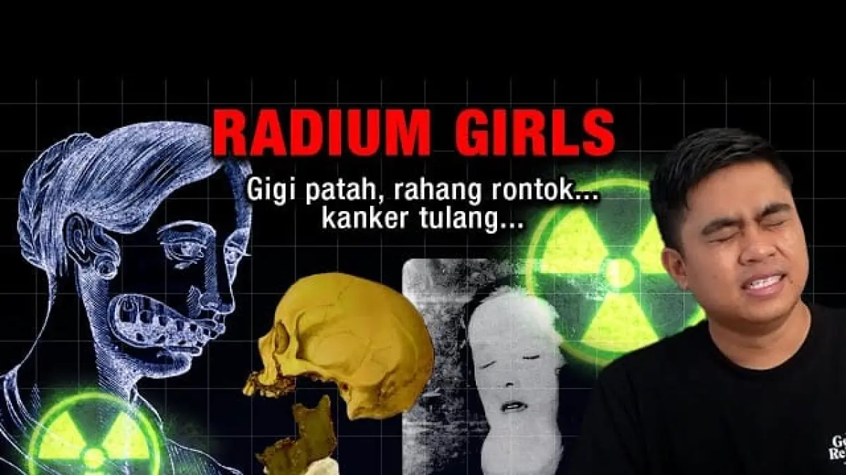 Paparan racun radioaktif radium terhadap para pekerja pabrik. (angkapan Layar YouTube Fajrul Fx)