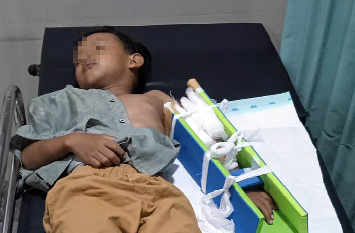 APES: Korban ADNR saat dirawat di RS Prima Husada Sukorejo.