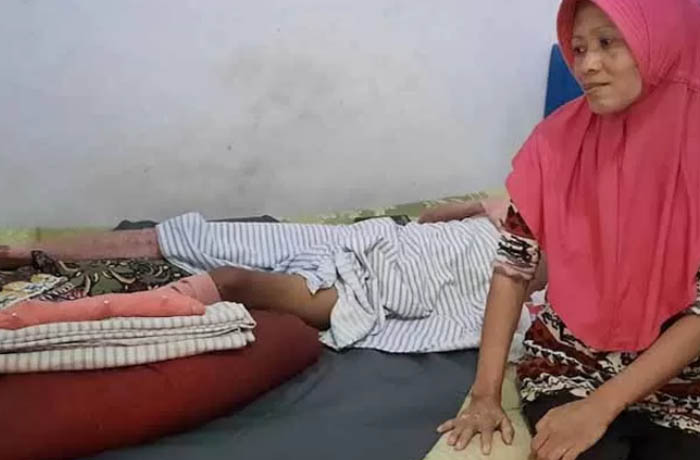 TRAUMA: Sholihin korban ledakan mercon di Sunan Bonang. (Foto: Fahrizal Firmani/Jawa Pos Radar Bromo)