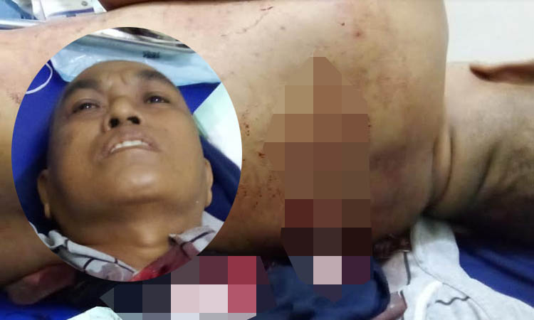 TERLUKA: Samito yang terluka usai dibacok pelaku begal.