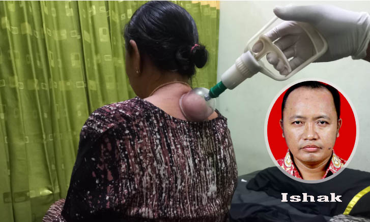 JAGA KESEHATAN: Salah satu pasien bekam kering di Holistic Nursing Therapy Kabupaten Probolinggo, Rabu (6/9) malam. Inset, Ishak Kepala Puskesmas Krucil.