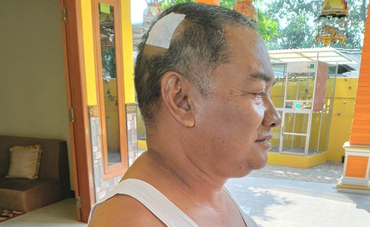 DIPERBAN: Habib Yusuf Asegaf ditemui di rumahnya. Dia mengalami luka di kepala, setelah jadi korban pengroyokan.