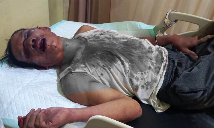 SUDAH SEMBUH: Zaini saat masih dirawat di RSUD. Dia kini sudah ditahan di Mapolres Probolinggo.