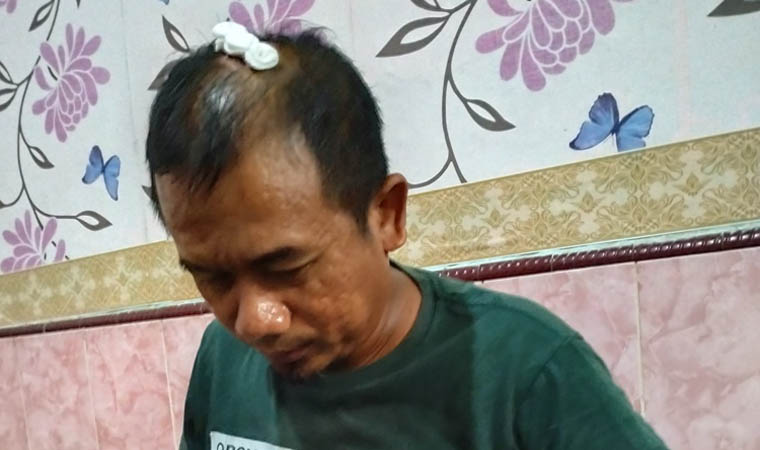TRAUMA: Joni, salah seorang korban luka-luka, rombongan ziarah wali lima asal Jetak.