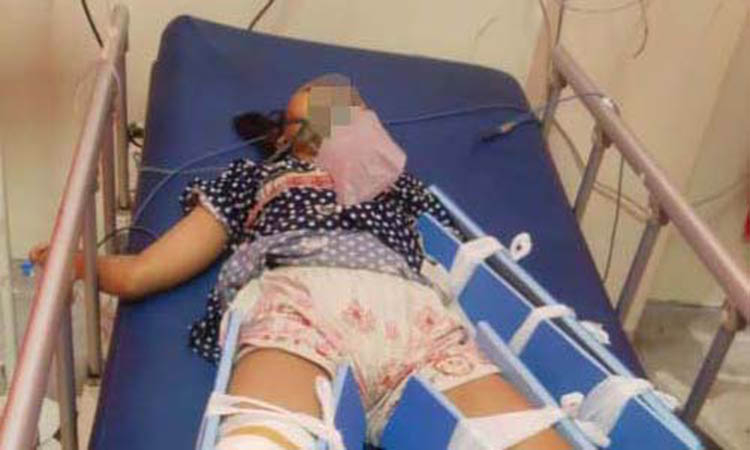 DALAM PERAWATAN: SU, anak Soleh saat masih perawatan di RSUD Grati.