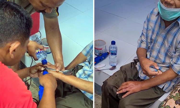 Petugas Damkar saat berupaya mengevakuasi cincin kekecilan yang melilit jari Sumitro