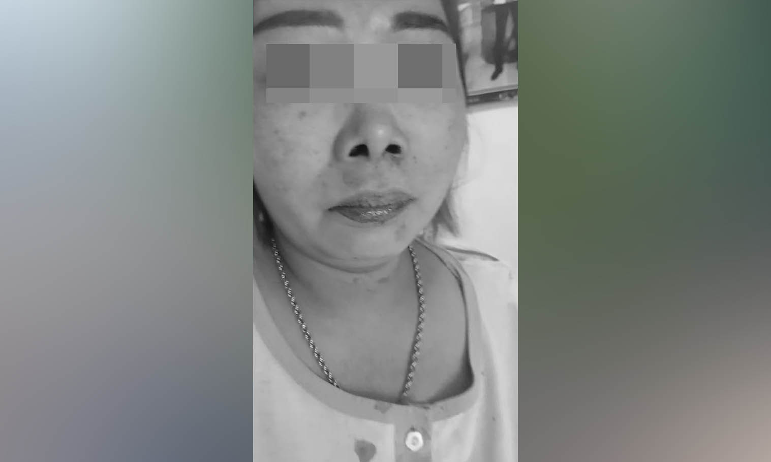 TAK TERIMA: Suwarni yang mengaku dianiaya bosnya di sebuah vila di Kecamatan Sukapura.