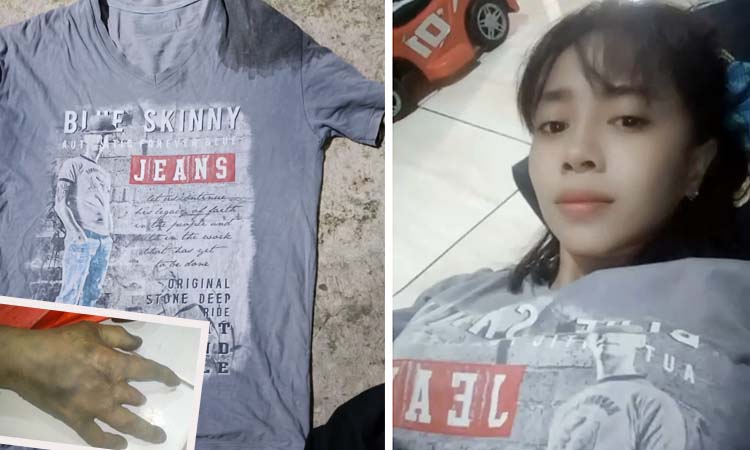 DIIDENTIFIKASI: Korban semasa hidup (kanan). Inset baju yang dikenakan korban dan kondisi tangan korban yang membuatnya bisa dikenali.