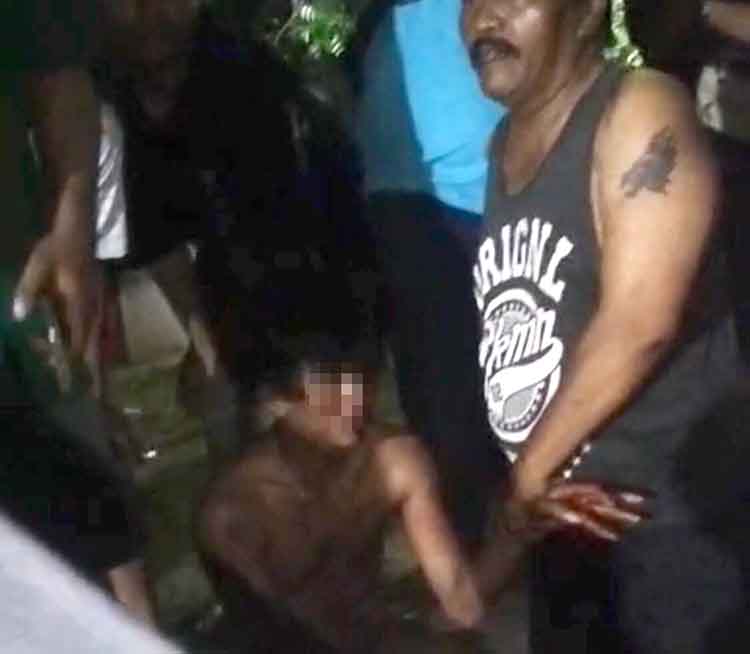 TERLUKA: Seorang remaja berinisial MUZ asal Kecamatan Sumberasih, Kabupaten Probolinggo, yang sempat menjadi sasaran amukan warga setelah diduga maling motor, Kamis (26/6) lalu.
