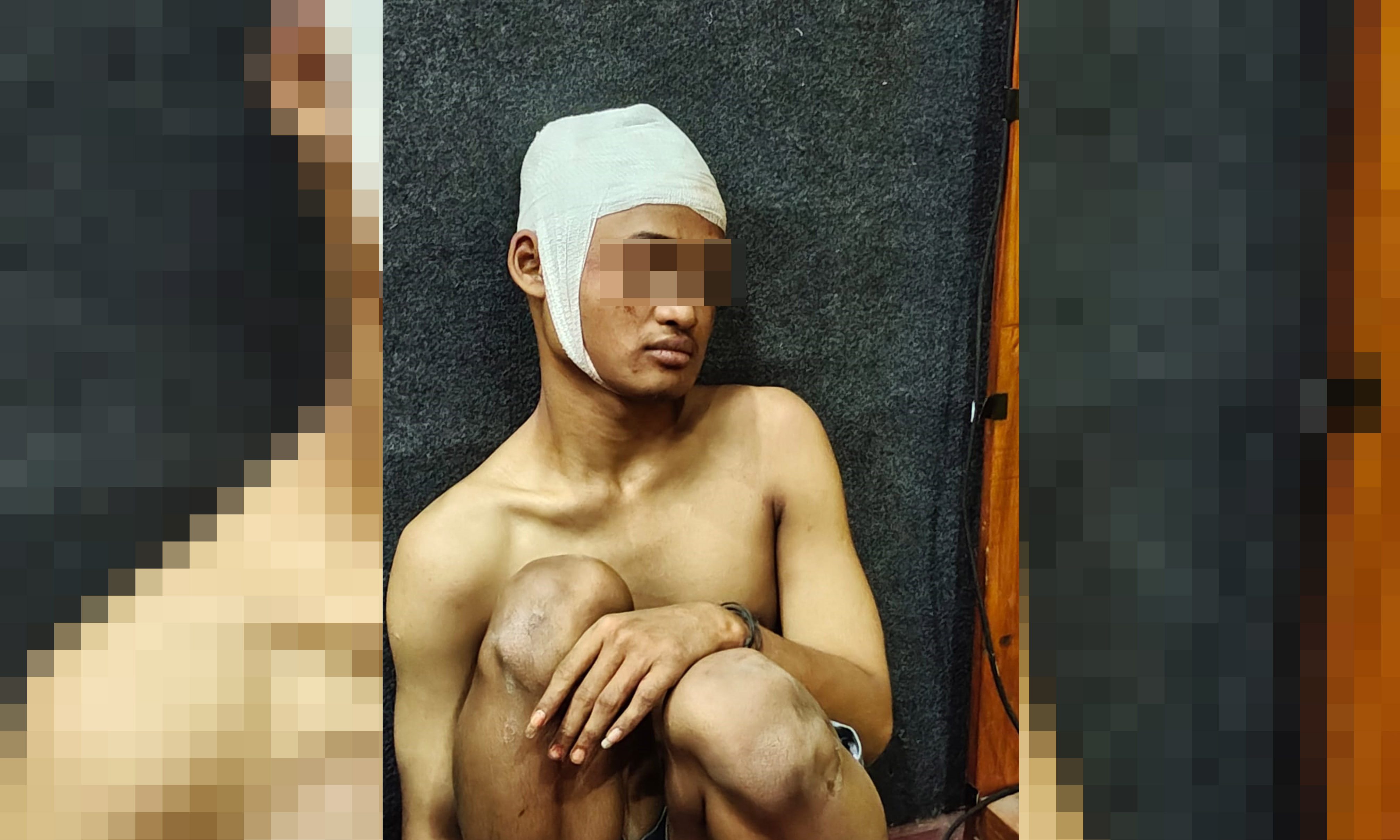 TERGELETAK: Abdullah Maimun, usai kecelakaan yang dialaminya. Sudah jatuh ketiban tangga. Sudah luka-luka akhirnya masuk penjara.