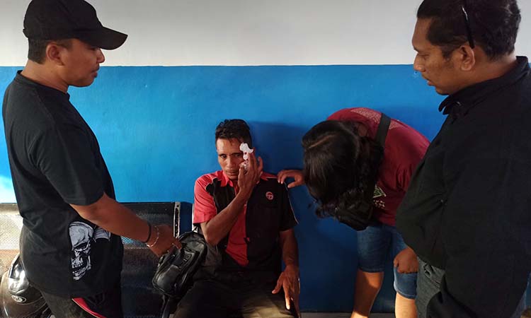 APES: Korban memegangi pipinya yang dibalut perban usai menerima sayatan benda tajam dari pelaku yang kini diburu polisi.