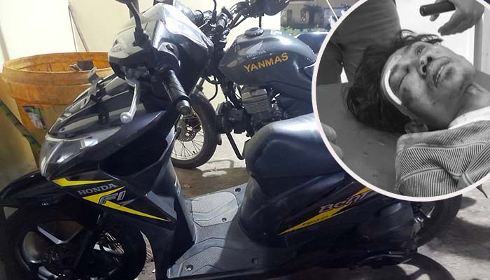BARANG BUKTI: Motor pelaku saat diamankan. Inset pelaku Agus Hariyanto saat dirawat. Rekannya, kini masih diburu.