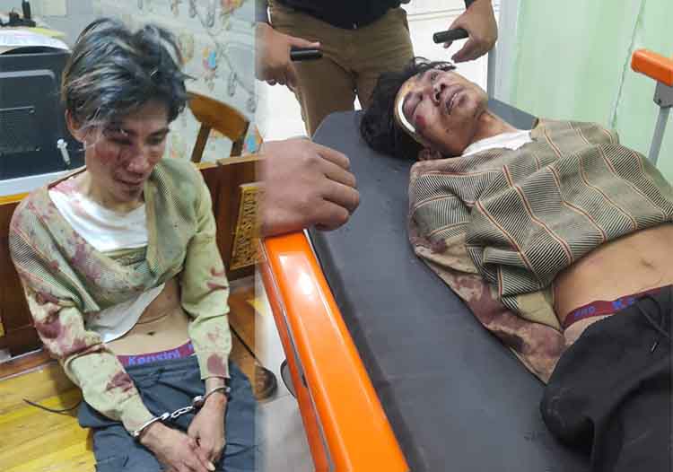 TERLUKA: Tersangka Agus Hariyanto, babak belur usai dimassa lantaran mencuri motor milik Moh. Hendrawan. Ia lantas diamankan ke Polsek Tongas, Selasa (26/8) malam.