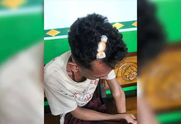 TERLUKA: Kepala Nabil Rohman, warga Desa Jorongan, Kecamatan Leces, terluka setelah dibacok begal Rabu (24/9) dini hari.