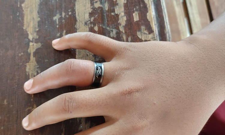 SEBELUM TERLEPAS: Jari manis WH yang bengkak karena cincin.